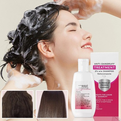 Nizoral Anti Dandruff Shampoo Reats And Prevents Dandruff Flaky Scalp Shampoo2pc