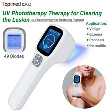 308nm UVB Phototherapy Device Portable Home Use for Skin Disorders 49 Diodes