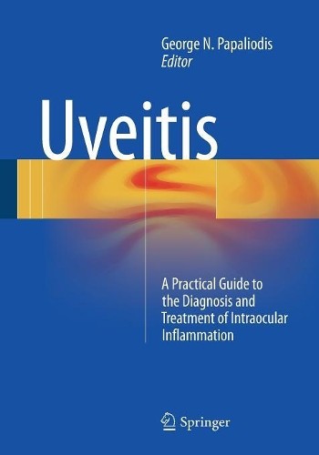 Uveitis - 9783319091259