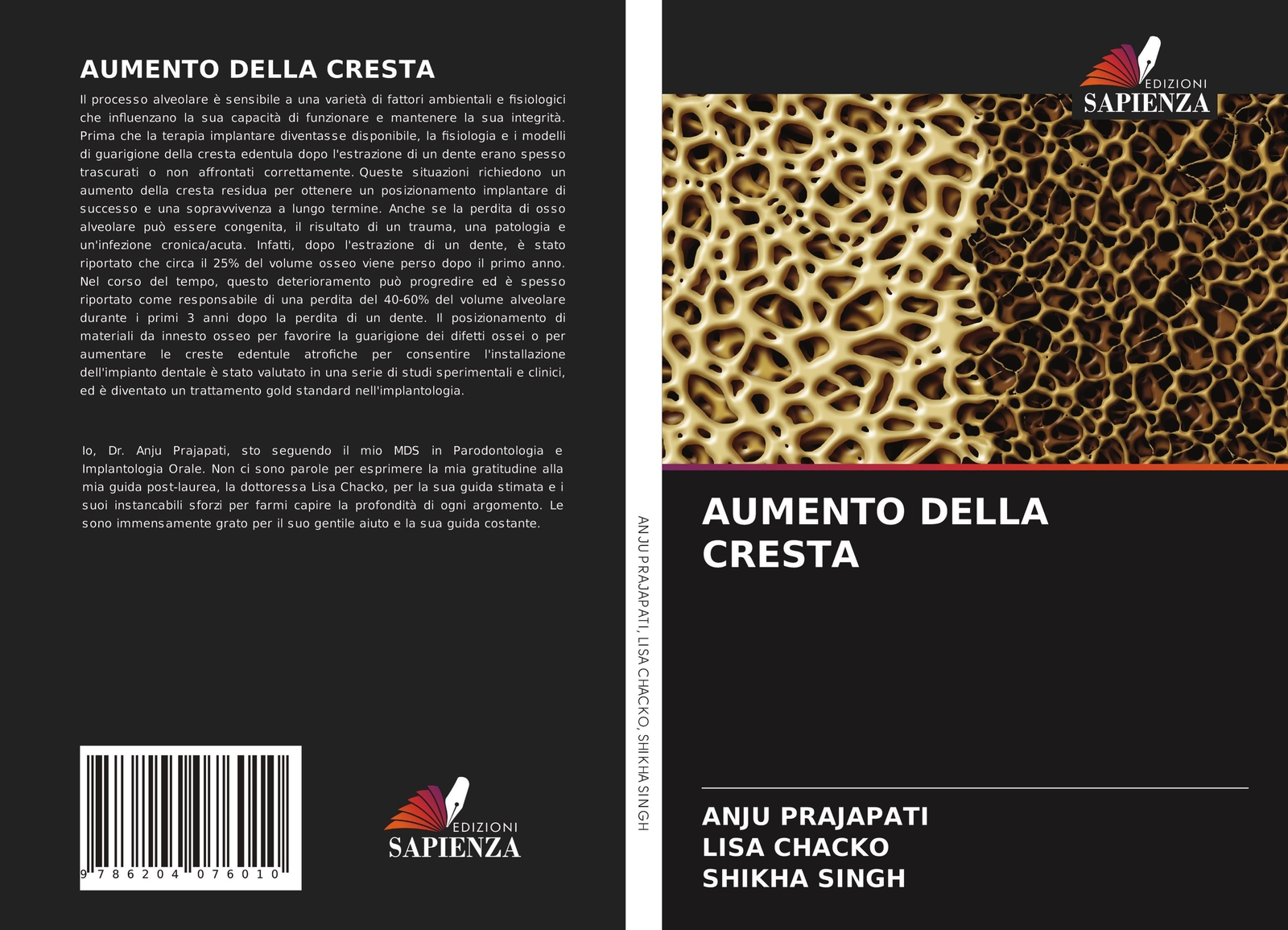 Thumbnail - Aumento Della Cresta Anju Prajapati (u. A.) Taschenbuch Paperback