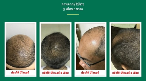 Neo Hair Lotion Green Wealth for Hair Growth Root Prevent Hair Loss 120ml - Picture 2 of 9