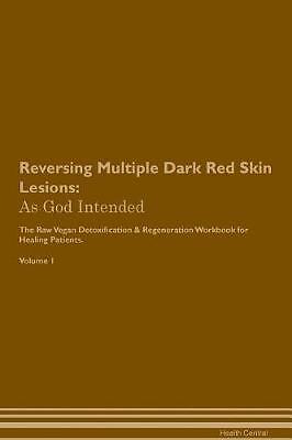 Reversing Multiple Dark Red Skin Lesions, Health C