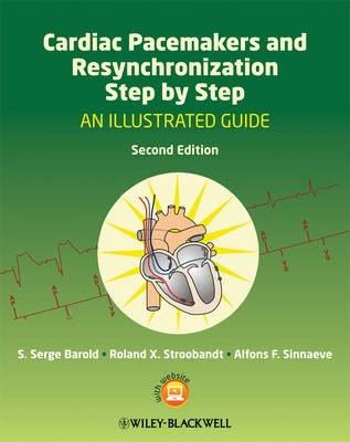 Cardiac Pacemakers and Resynchronization Step by S