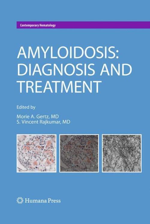 Thumbnail - S. Vincent Rajkumar (u. A.) | Amyloidosis | Buch | Englisch (2010) | X