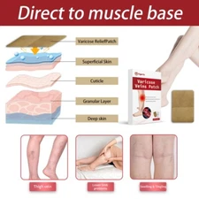 10 Varicose Veins Patch Leg Circulation Boost Phlebitis Comfort Support tigerty