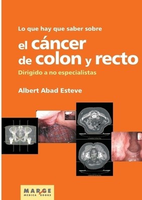 Albert Abad Est Lo que hay que saber sobre el cáncer de colon y re (Taschenbuch)