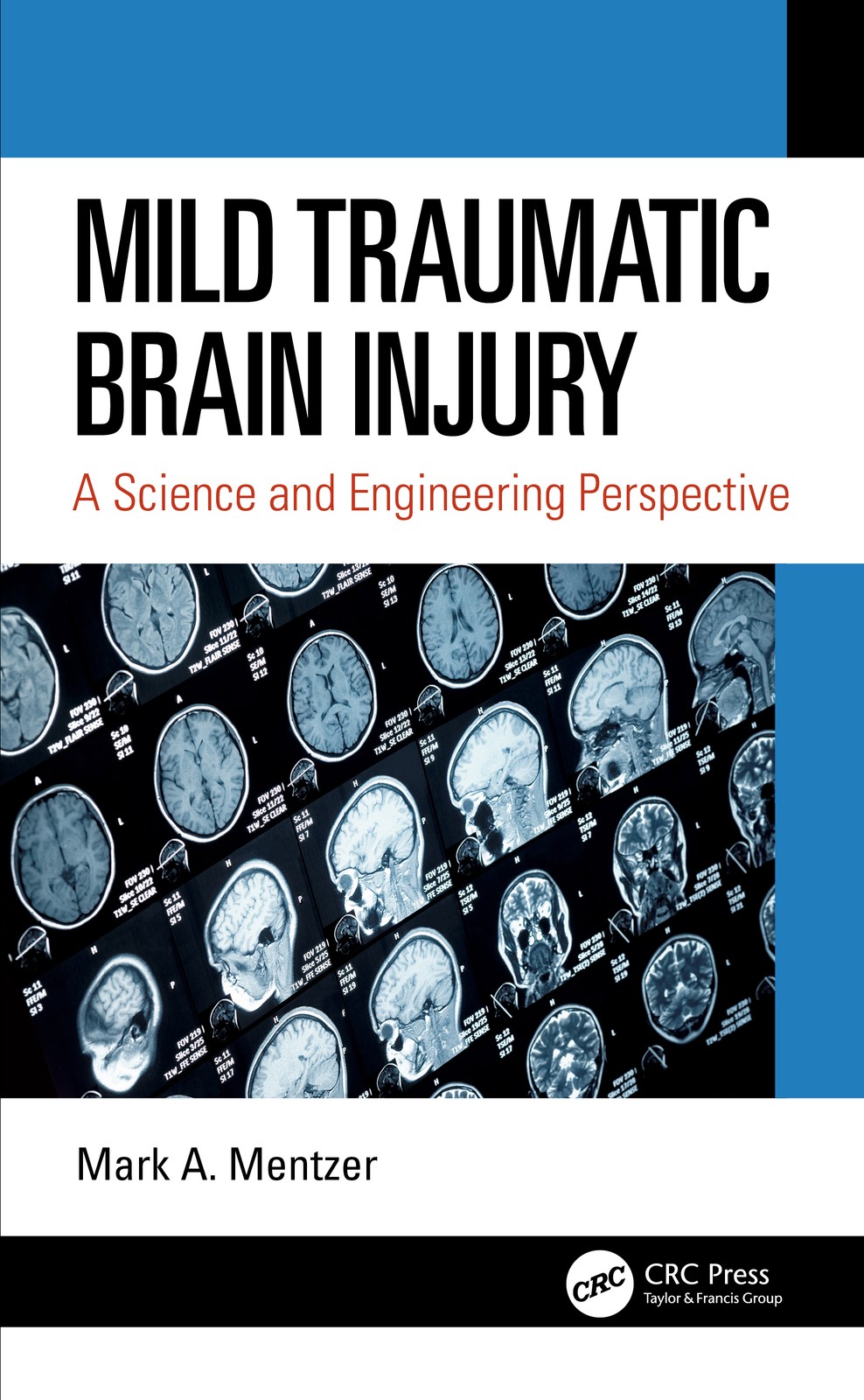 Mild Traumatic Brain Injury