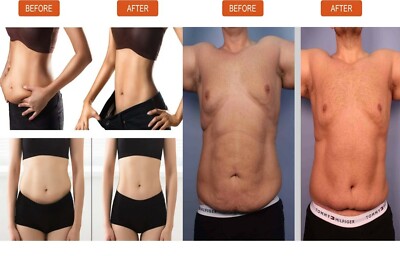 UNISEX Slim Patch Bauch Fatburner Abnehmen Pflaster Abnehmen Extra Stark UK