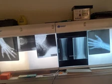 SCRAP X-RAY FILM - 1LB (Silver Recovery/Teaching/crafts)