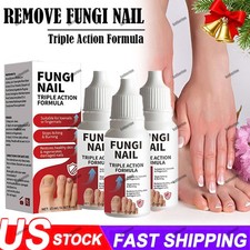 Fungi-Nail Anti-Fungal Liquid Solution Kills Fungus That Can Lead To Nail