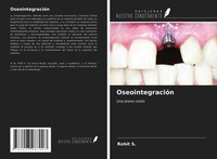 Rohit S. | OseointegracióN | Taschenbuch | Spanisch (2021) | Una Breve VisióN