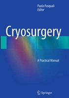 Paola Pasquali | Cryosurgery | Taschenbuch | Englisch (2016) | Xviii | Springer