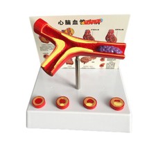Human Atherosclerosis Cardiovascular Model Blood Vessel Anatomical Model 10Times