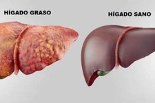 tnc Clin Limpia tu higado con: Cardo Mariano, Cancerian, Alcachofa, Noni 60 Caps