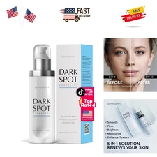 Dark Spot Remover Face & Body Serum: Age Spot Sun Spot Freckles Melasma Brown...