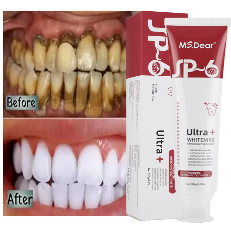 SP-6 Probiotic Whitening Toothpaste Refresh Mouth Brighten Remove Yellow Tooth