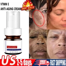 Effective Whitening Freckle Cream Remove Dark Spot Cream Removal Melanin Melasma