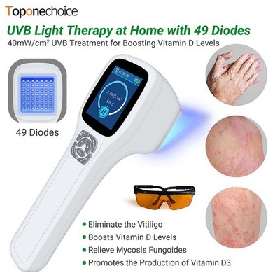 Professional 308nm Excimer Phototherapy Device for Skin Disorders for Home Use