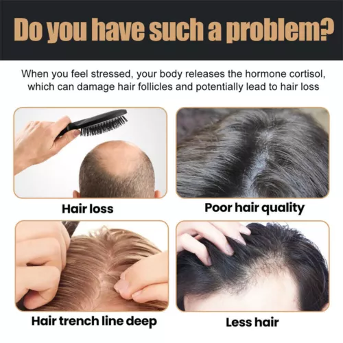 1-5X Root Activator Shampoo, SPARTAN Hair Loss Shampoo,Shampoo Root Activator - Picture 3 of 9