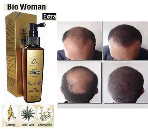 5 x BIO WOMAN HAIR LOSS TONIC EXTRA STRENGTH TREATMENT FAST GROW REGROWTH REGROW - Image 2 of 3