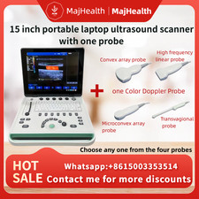 15 inch portable laptop ultrasound scanner with one probes
