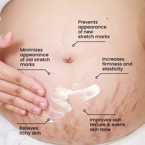 ThriveCo Stretch Marks Expert Serum Cream | Improves Stretchmarks | 30ml - Picture 5 of 9