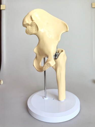 Artificial Shoulder replacement Anatomical model Knee Shoulder Elbow joint model - Picture 26 of 47