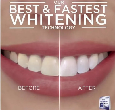  20 WEISSE ZAHNAUFHELLUNGSSTREIFEN (10 PACKUNGEN) 3D Professional Bright White  