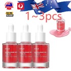 1~3x Anua Niacinamide 10% + TXA 4% Dark Spot Correcting Serum 30ml/ 1.01 fl. oz