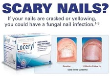  The Latest   Nail Fungal Lacquer 2.5ML FREE  FAST SHIPPING World Wide