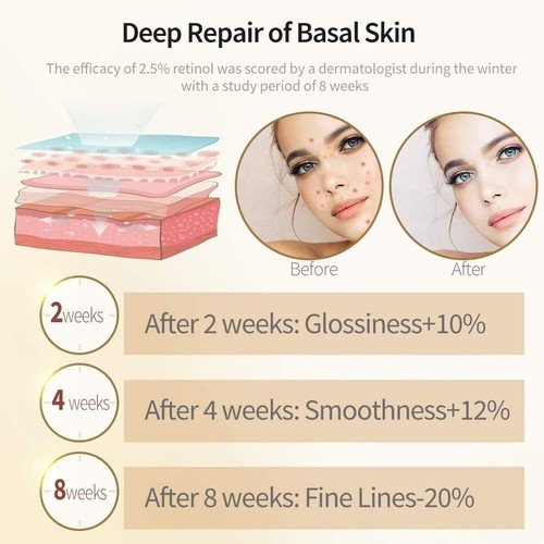 Retinol Serum 60 ml. Hochfestes Anti-Aging Serum Mit 2,5% Retinol Hyaluronsäure - Bild 5 von 5