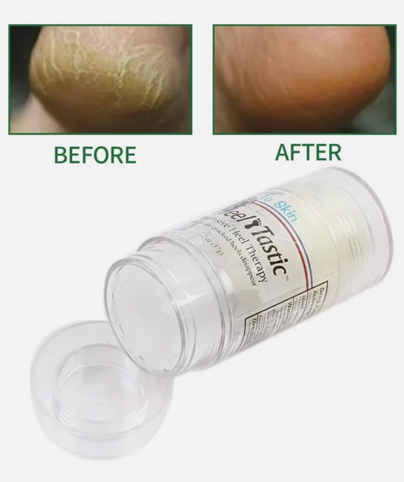 Heel Tastic Terapia Intensiva del Talón, Cuidado de los Pies 2oz, ENVÍO RÁPIDO GRATUITO Foto 3 de 4