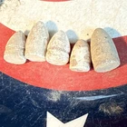5 Dug Civil War 💥 🇺🇸 💣 Assorted Pistol Bullets