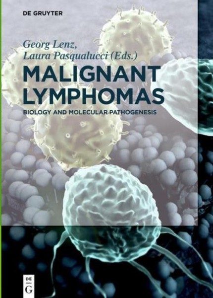 Malignant Lymphomas Laura Pasqualucci-image