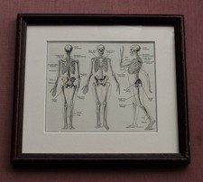 Human Skeleton ~ Anatomy framed Print – c.1880