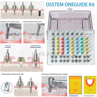 Dental OneGuide Implant Kit Compatible with OSSTEM ONEGUIDE Kit