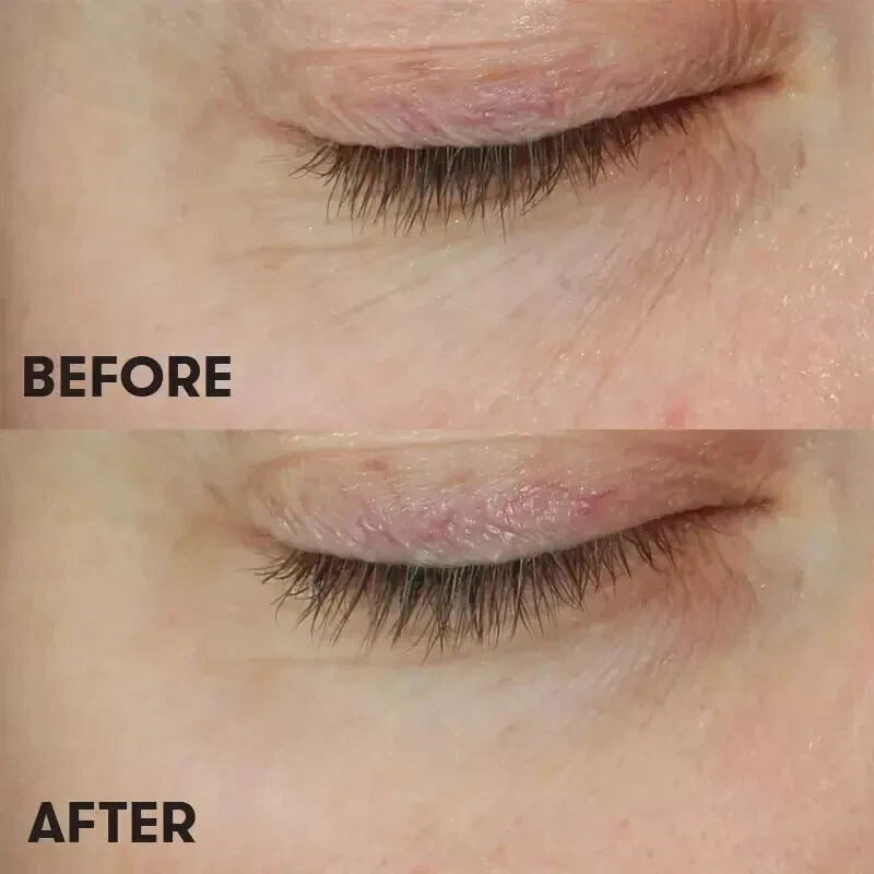 Увлажняющий гель-крем для глаз Skin Nutrition 15 мл - Изображение 3 из 3