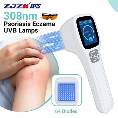 308nm Narrowband UVB Excimer Phototherapy Device for Eczema Skin Diseases