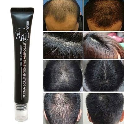 scalp derma jandel regrow 20ml ampoule intensive hairline