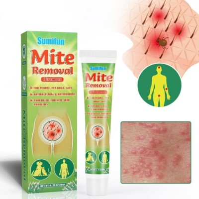 2-Pack Head Lice Removal Ointment Cream Treatment