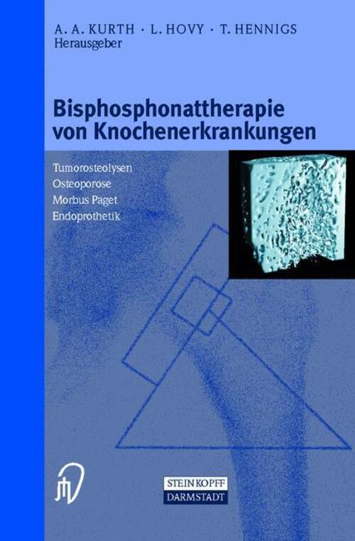 Thumbnail - Bisphosphonattherapie Von Knochenerkrankungen A. A. Kurth (u. A.)
