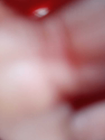 Bild 6 von 11