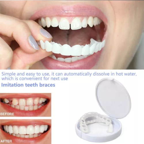 Set superiore e inferiore a scatto denti finti faccette dentali protesi copertura denti US - Foto 6 di 12