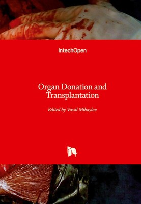 Vassil Mihaylov | Organ Donation and Transplantation | Buch | Englisch (2021)