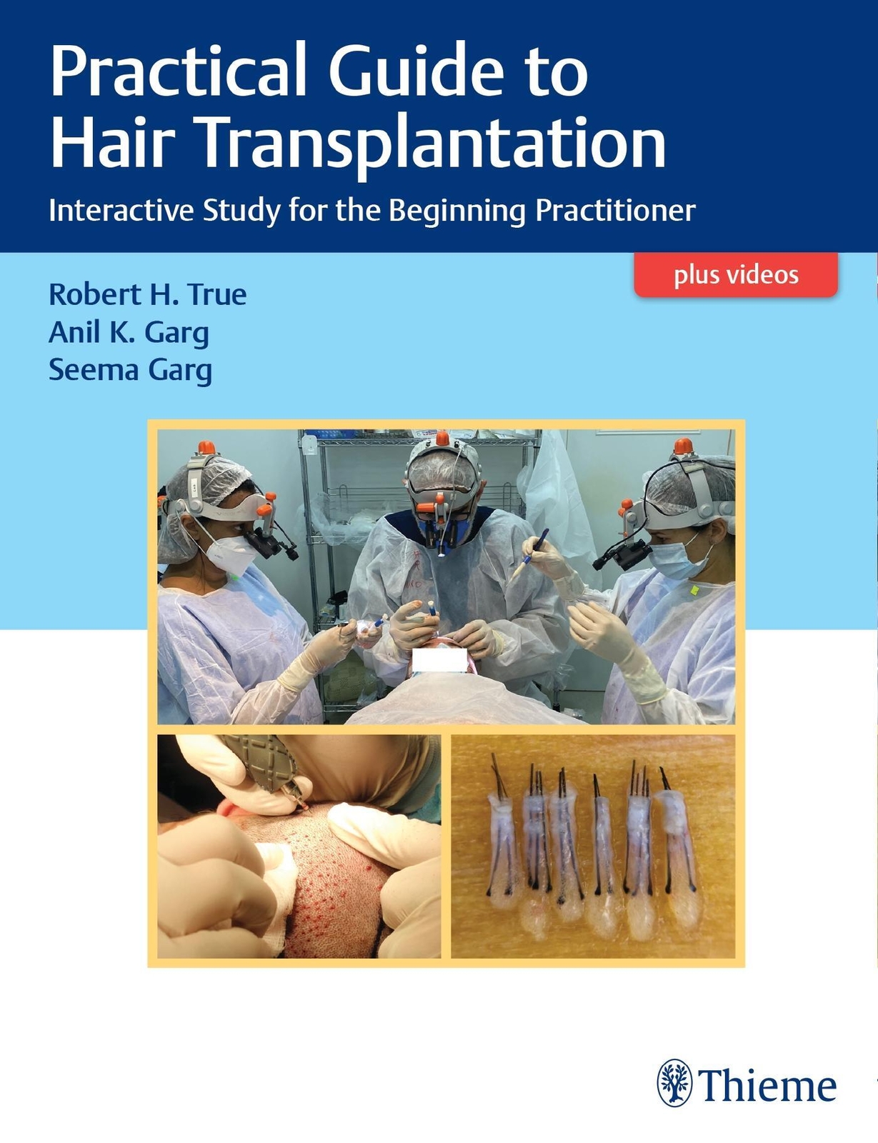 Thumbnail - Practical Guide To Hair Transplantation | Robert True (u. A.) |