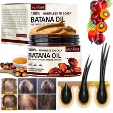 Natural Batana Oil Serum - Hair Growth Healthier Thicker Fuller Anti Hair Loss