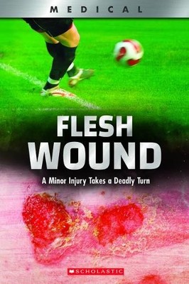 Shea Phillips Flesh Wound: A Minor Injury Takes a Deadly Turn (Xbook (Paperback)