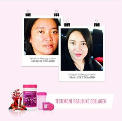 Aura White BEAULUXE PLUS SC 15X L-Glutathione Skin Whitening Collagen Stemcell
