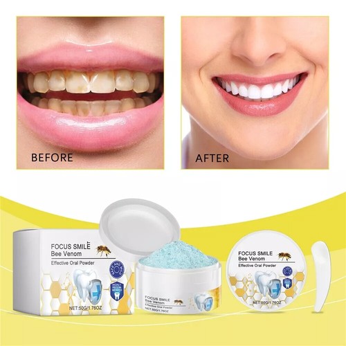 Bee Treatment Oral Powder, Bee-Venom Tooth Powder, Natural Tooth Powder - Picture 3 of 10