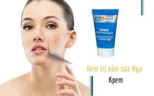 100ml Kem Tri Nam Kpem Nga . Trang Da, Mo Nam hieu qua